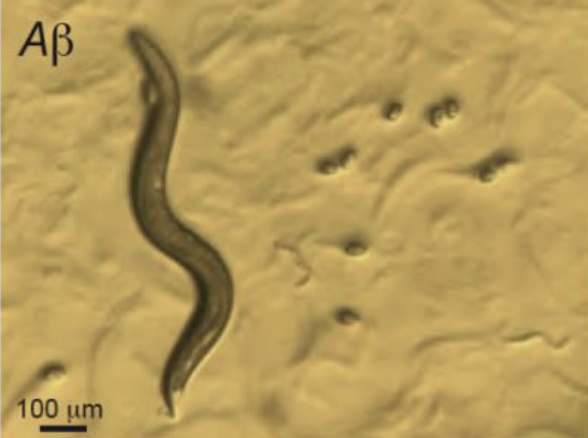 agente protector enfermedades neurodegenerativas